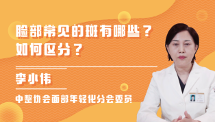 脸部常见的斑有哪些？