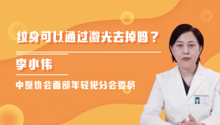 纹身可以通过激光去掉吗？