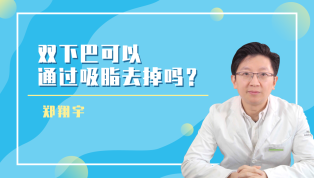 双下巴可以通过吸脂去掉吗？