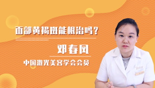 面部黄褐斑能根治吗？