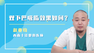 双下巴吸脂效果如何？