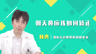 朝天鼻应该如何矫正？
