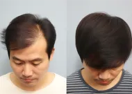 龙岩协和整形美容医院CT口腔内窥镜检查到底可以维持多久