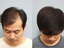 整形,医院,美容,口腔知识