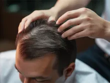 双眼皮,三大知识
