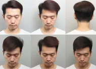 半**纹眉效果维持几年？3大因素决定褪色周期