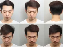 纹眉,效果,几年,因素知识