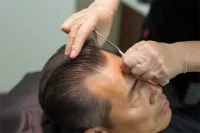 北京植发医院，科发源凭啥这么牛？