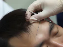 整形,眼整形,机构知识