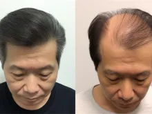 整形,医院,哪家,整形医院知识