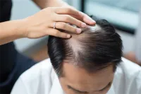 南昌植发医院怎么选？2023新正规机构实力对比榜单出炉！