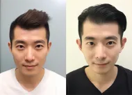 林州私密整形专属护理方案如何提升服务体验？