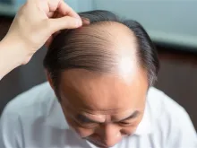 矫正,口碑知识