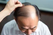 长治儿童上颚突牙矫正高手盘点,口碑卓越!