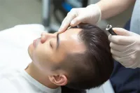 温州头顶加密种植医院多少钱