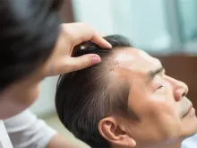 眼科,矫正,技术,手术知识