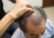 广州脂肪填充选哪位？南方医院五大专家案例解析