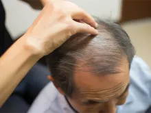 医院,广州,脂肪,专家知识