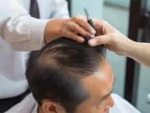 美容,除皱知识