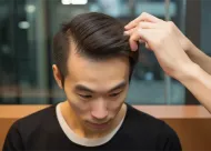 广州祛眼袋恢复期揭秘：健丽VS曙光术后恢复时间对比